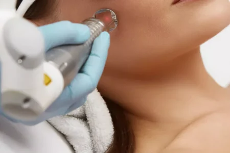 Laser co2 - zastosowania w medycynie estetycznej