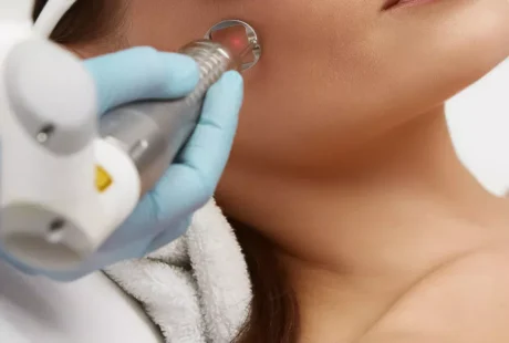 Laser co2 - zastosowania w medycynie estetycznej