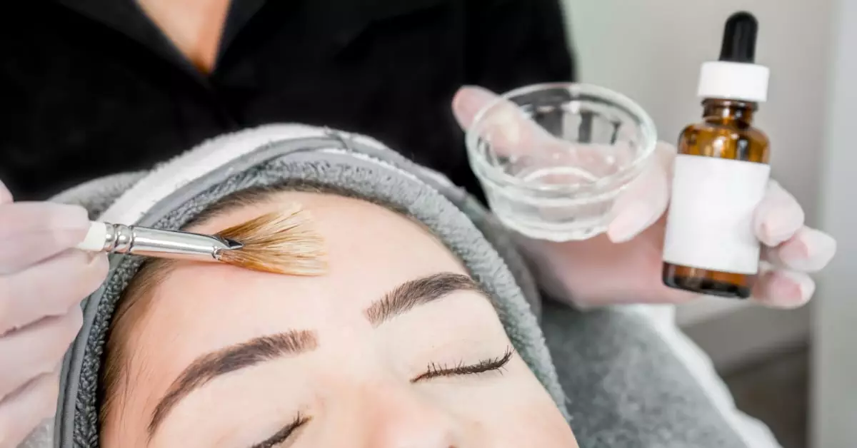 Co to jest peeling salicylowy?
